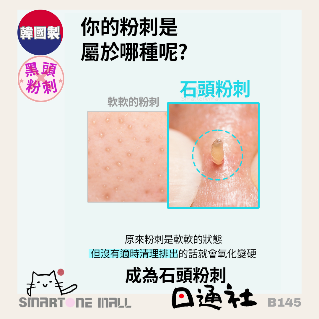 韓國直送：ilso Super Melting Sebum Softener 黑頭粉刺溶解液套裝 (B145)